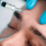 Aesthetic medicine products. Dermal Fillers And Scars: Cost, Effects & Benefits Reviewed